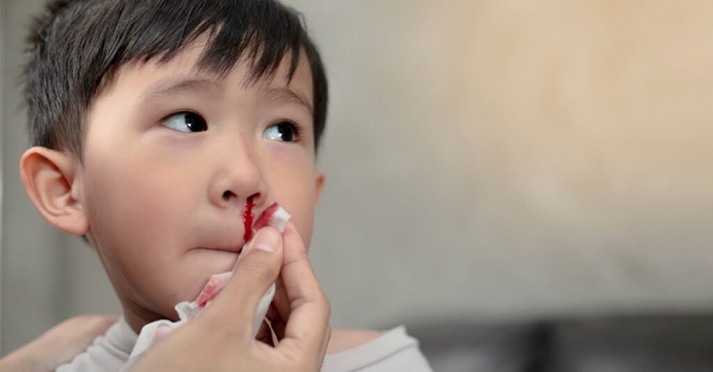 Why Does My Child Have Frequent Nosebleeds? Causes, Prevention, and Ayurvedic Remedies